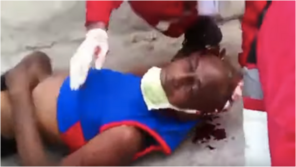 VÍDEO: "eles o mataram", dizem cubanos carregando ferido em protesto contra o governo