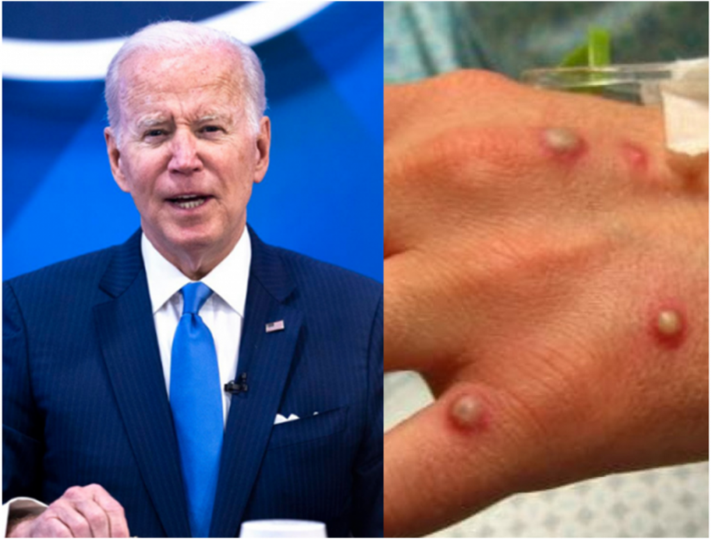Biden alerta sobre novo surto, agora da varíola do macaco: 'Deve preocupar a todos'